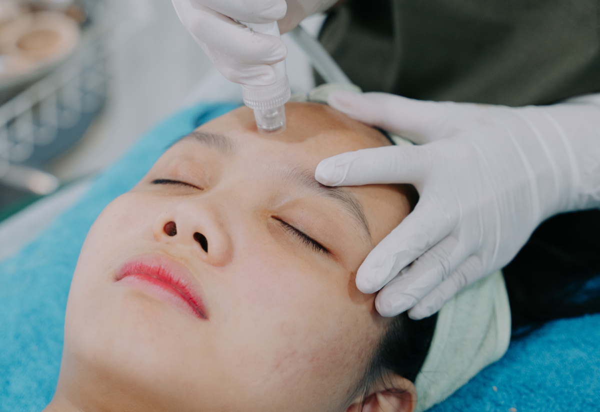 Rejuran HB treatment