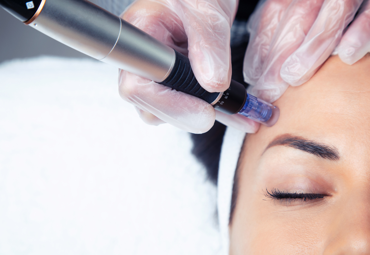 Rejuran HB treatment