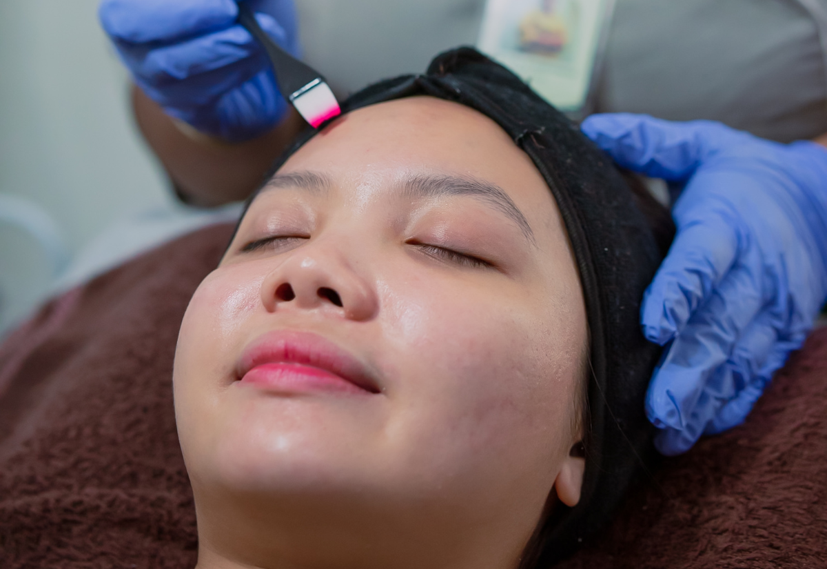 Rejuran HB treatment
