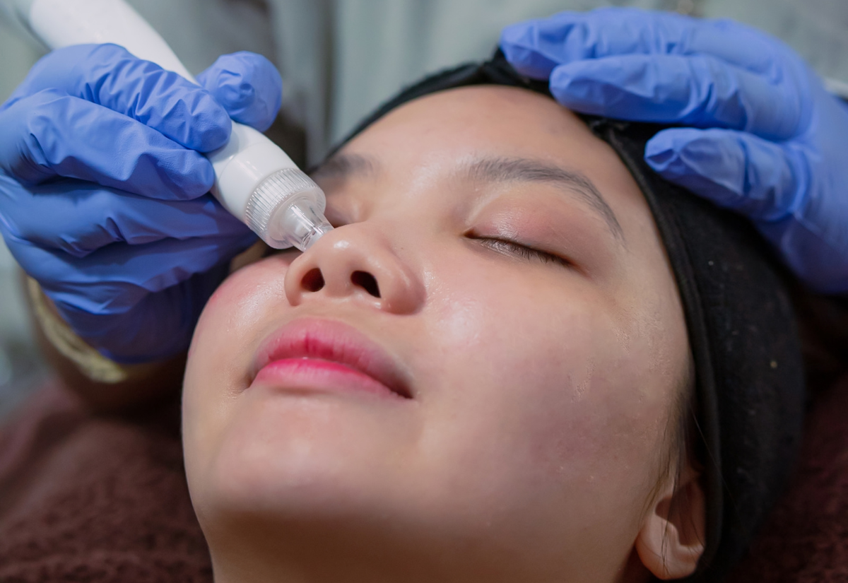 Rejuran HB treatment