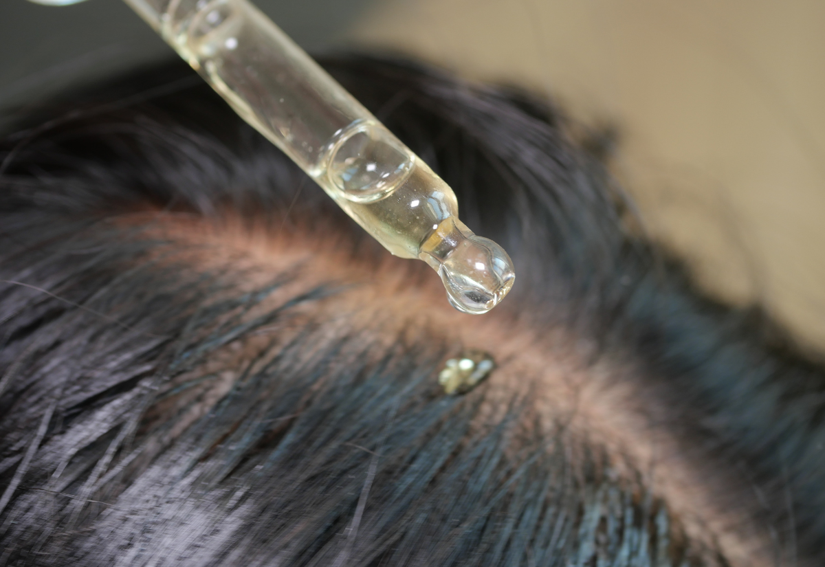 Rejuran HB treatment