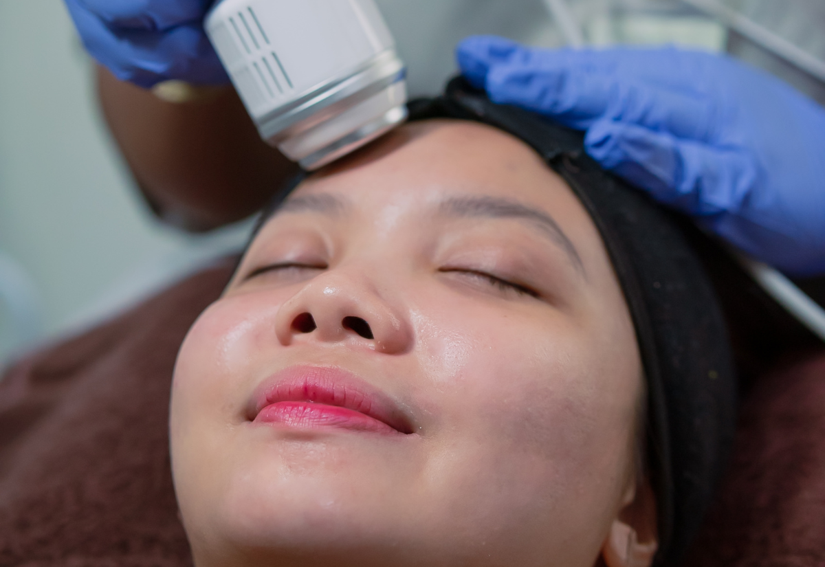 Rejuran HB treatment