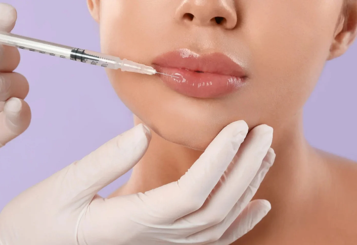 Rejuran HB treatment