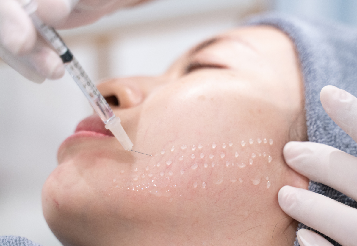 Rejuran HB treatment